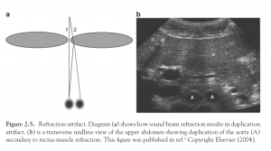 Effects of refraction in ultrasonography